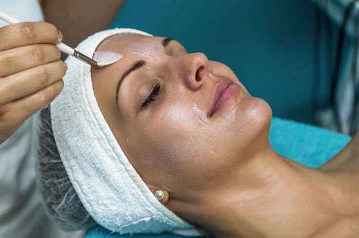 Chemical Peels Treatment